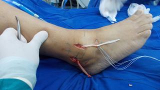 especialistas de rodilla en maracaibo Carlos Arévalo. Traumatología y Ortopedia.