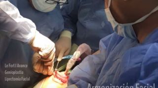 clinicas acido hialuronico maracaibo Clinica de Cirugia Bucal y Maxilofacial - Dr. Dubines Ramírez Matheus - Cirugia Oral - Implantes Dentales - Ortognatica - Bichectomia - Cordales - ATM